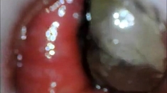 anal endoscope ass play from inside